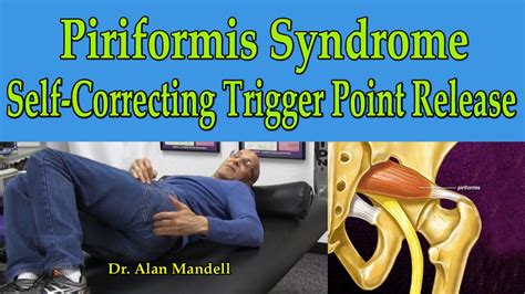 Achieve Sweet Dreams with These Proven Strategies for Sleeping Comfortably with Piriformis Syndrome